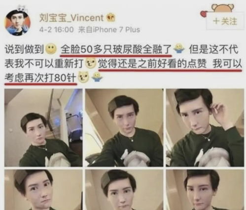一夜爆红整成蛇精脸,尺度视频全网传
