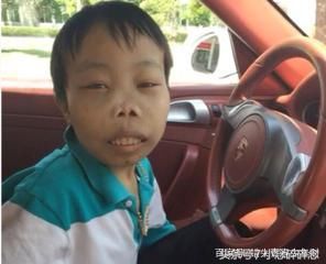 因丑出名的快手网红陈山,被封杀后漂亮女友和其分手还说出这种话