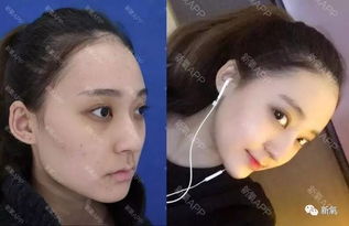 比起快手网红和怀孕7个月女友街头撕打的戏码,这个用杨幂同款整形项目整成迪丽热巴的妹子更励志