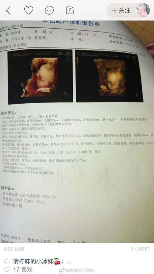 快手14岁女孩晒怀孕,你怎么看