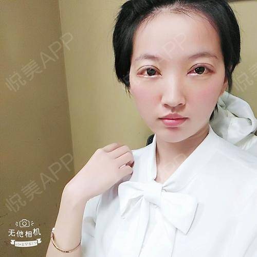 羡慕这两年什么抖音呀快手呀这些娱乐app上那些美女...眼综合整形悦美整形