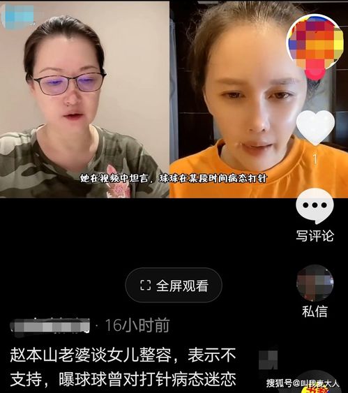 辛巴讨好球球吃相难看,赵本山妻子曝光女儿沉迷整容,已成病态
