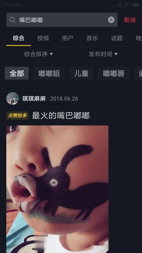 先成为内容之王,才能成为抖音之王