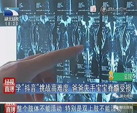 据说最近全民都在玩抖音危险动作请勿模仿