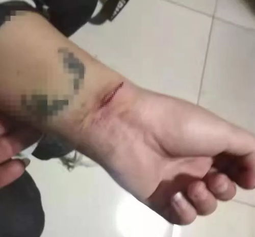 通辽一女子快手直播上演割腕自杀竟因与男友产生情感纠葛