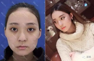 比起快手网红和怀孕7个月女友街头撕打的戏码,这个用杨幂同款整形项目整成迪丽热巴的妹子更励志