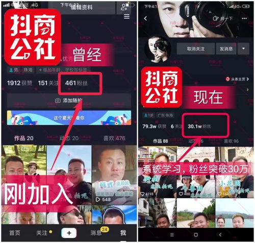 抖音合集怎么开通抖音合集设置步骤详解