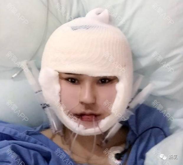 比起快手网红和怀孕7个月女友街头撕打的戏码,这个用杨幂同款整形项目整成迪丽热巴的妹子更励志