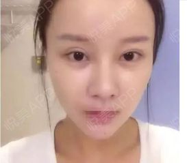 网红大方承认做过眼综合,快手抖音里的美女都是假的
