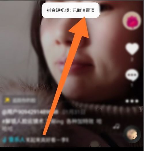抖音怎么取消置顶