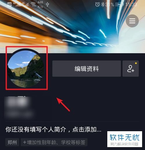 如何解决抖音弹出个人资料更新提示的问题