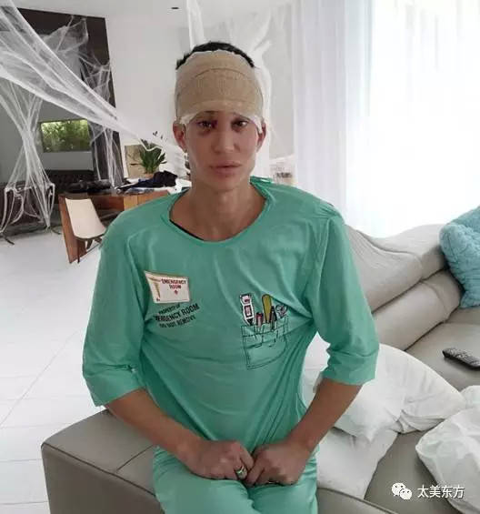 整形or变异盘点那些审美奇葩的整容网红们