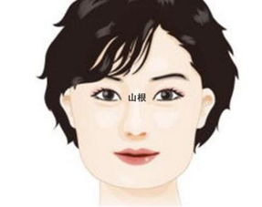 鼻子塌怎么办