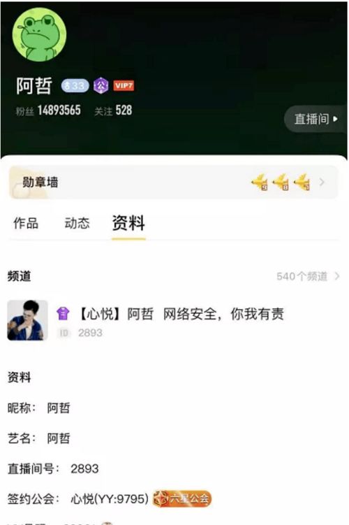 阿哲脱心悦马甲yy最狗主播九情夺冠伽柏喜提劳斯莱斯众主播眼馋