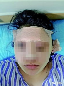 济南女孩为当网红陷入贷款整容圈套记者暗访要想红就得先整容