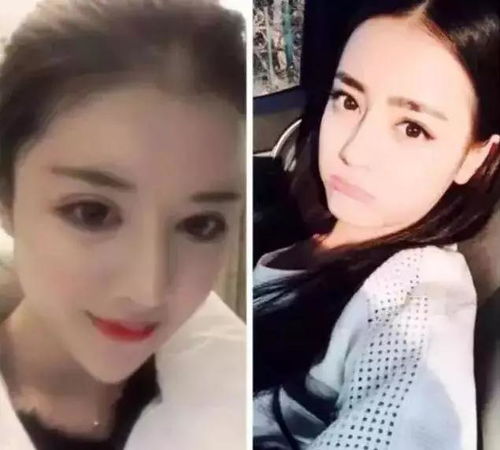 少女花100万整成外围女,网友我的天啊